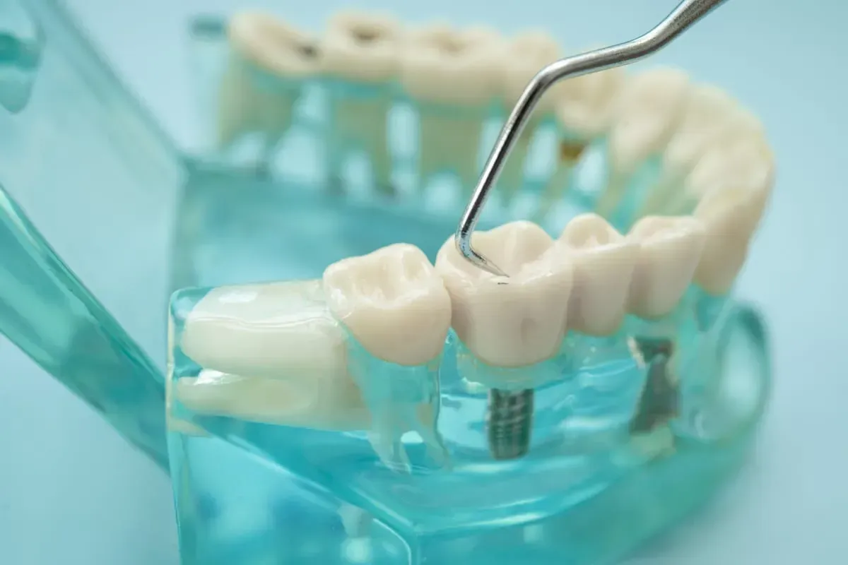Restorative Dentistry: Rebuilding Your Smile in Newark