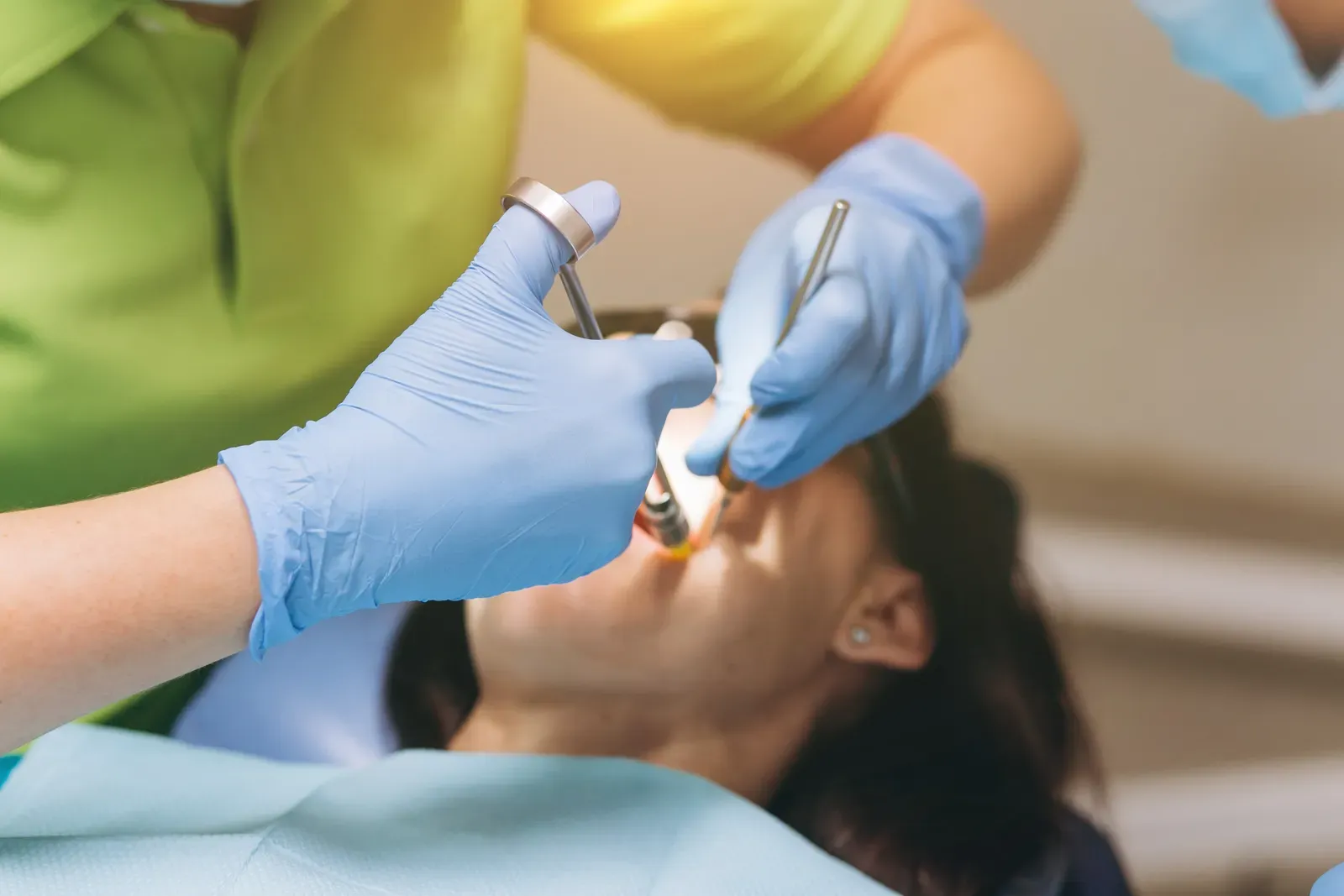 Tooth Extractions: What To Expect Before and After in Newark